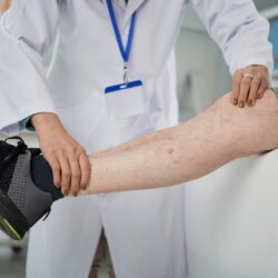 Топлото време може да направи тежестта и подуването на.